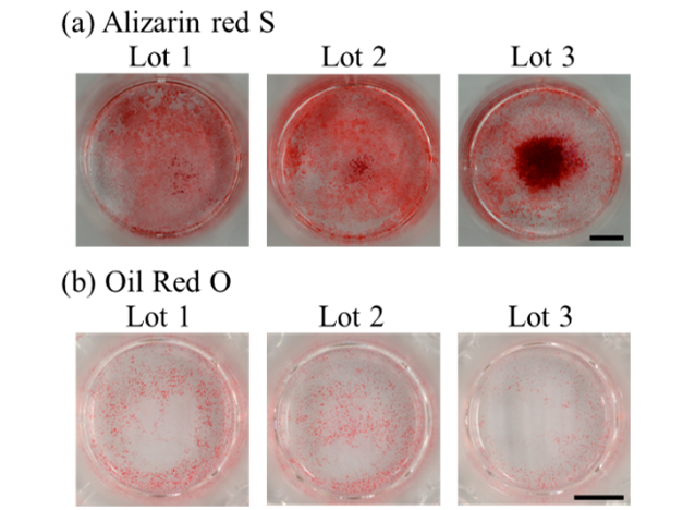 【間葉系幹細胞の分化能の違い】 (a)骨芽細胞分化誘導後のアリザリンレッドS染色　　　　　　　　　　　 (b)脂肪分化誘導後のオイルレッドO染色：ロットによって分化の差が著しい