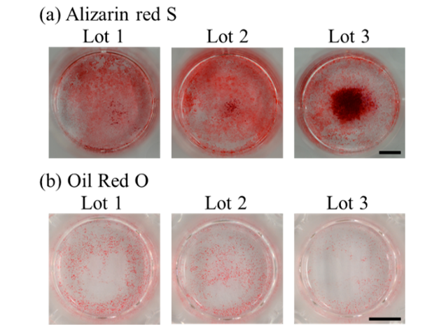 間葉系幹細胞のばらつきを乗り越える分化予測方法 | 東京都立