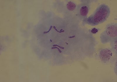 顕微鏡で確認できる性染色体の姿