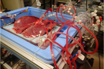 臓器保存装置
