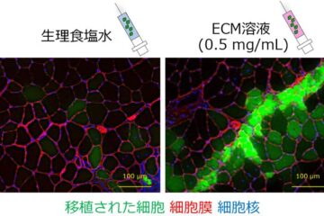 高齢者のサルコペニア予防にも期待！筋芽細胞移植による骨格筋の再生技術